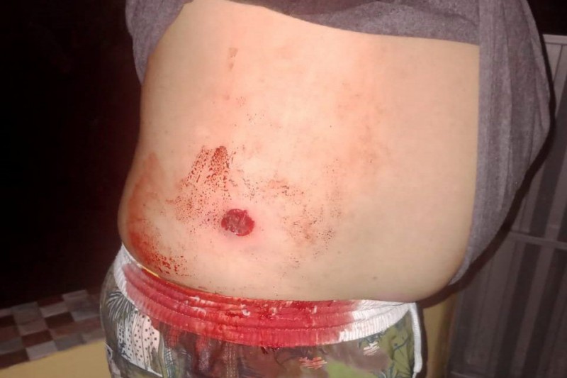 Foto: Divulgação - Produtor rural é baleado e família expulsa durante invasão indígena em fazenda de Porto Seguro