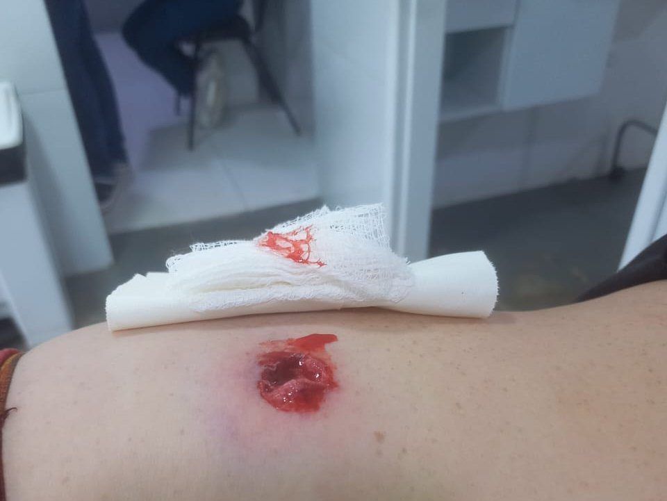 Produtor rural foi baleado na região do abdômen durante a invasão à Fazenda Produtor rural foi baleado na região do abdômen durante a invasão à Fazenda